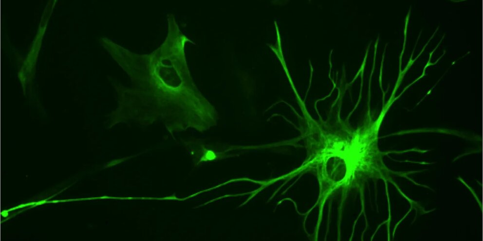 27304 Астроциты разрушают связи в головном мозге, чтобы поддерживать нейропластичность